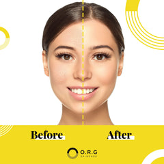 O.R.G. Skincare Peel Off - image avant-après montrant une peau plus lumineuse.
