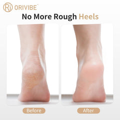 Orivibe: rouleaux fin et gros pour exfoliation efficace.