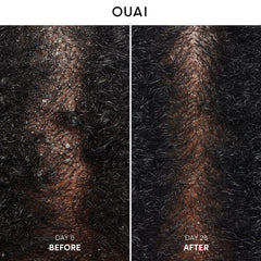 OUAI shampooing antipelliculaire, mousse douce pour démêler et nettoyer le cuir chevelu.