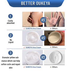 OUKEYA Crème Urée 40 %, soin efficace pour pieds et mains sensibles.
