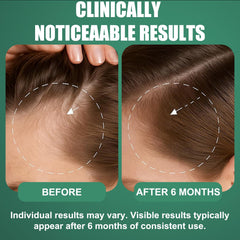 OURMUST Minoxidil 5% prêt pour une routine quotidienne simple et efficace.
