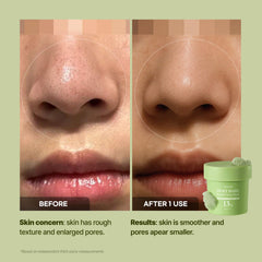 pcalm-nettoyage-pores-bulles-petillantes : Bulles pétillantes purifiant les pores et nettoyant sans effort.