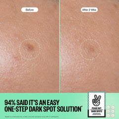 PEACE OUT Dots acide férulique protection antioxydante pour le visage.
