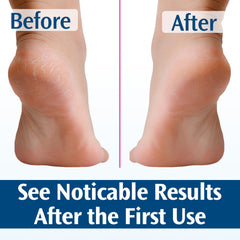 Pedifix Crème Pieds, adoucit callosités, peau plus lisse