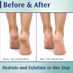 Pedifix Crème Pieds Utilisation Quotidienne pour pieds hydratés et doux.