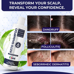 Shampooing Pharmlitalia texture-mousse – expérience lavante agréable et cheveux propres.