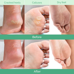 PLANTIFIQUE Masque Pied Peeling: teste dermato pour securite et confort