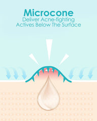 Plus1HEROLABS Microdart Patch application : pose rapide et confortable.