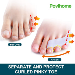Povihome séparateur petit orteil à trois orifices maintien sûr