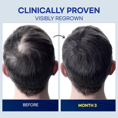 ProBliva non-greasy formula dries quickly after use