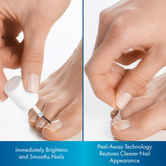 ProClearz Brite Now ongles brillants et uniformes après utilisation