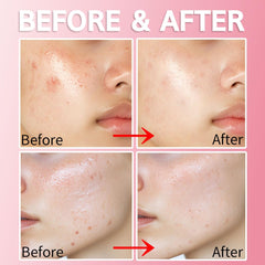 Purederm texture mate non gras – absorption rapide pour une peau uniforme.