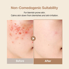 Purito Gel-Crème Calmante — application rapide sans effet collant.