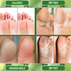 Talons lisses après utilisation grâce à une hydratation durable