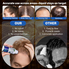 QYFJ Minoxidil: formule non grasse sans parfum pour cuir chevelu sain.