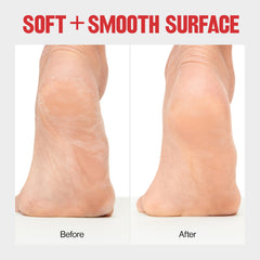 REVLON Callus Remover bac de réception capte les particules.