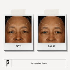 Rodan + Fields tonique affine-pores équilibre le teint et prépare la peau.