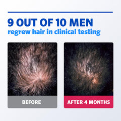Rogaine Mousse 5% pour homme, absorption rapide sans résidu.