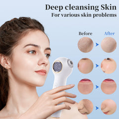 RONEFY aspiration réglable adaptée à différentes zones du visage.