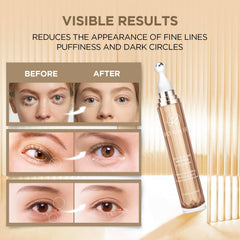 RONKIE Crème Yeux Caféine – anti-poches pour un regard éveillé.