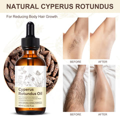 Emballage élégant de l’huile Cyperus Rotundus Rulviou pour la routine beauté.