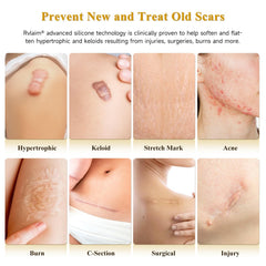 Rvlaim Scar Cream Silicone Gel – Application par la main, texture légère et non grasse.