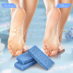 SALVMARY tampons-abrasifs-pieds jetables pour pédicure rapide à domicile.