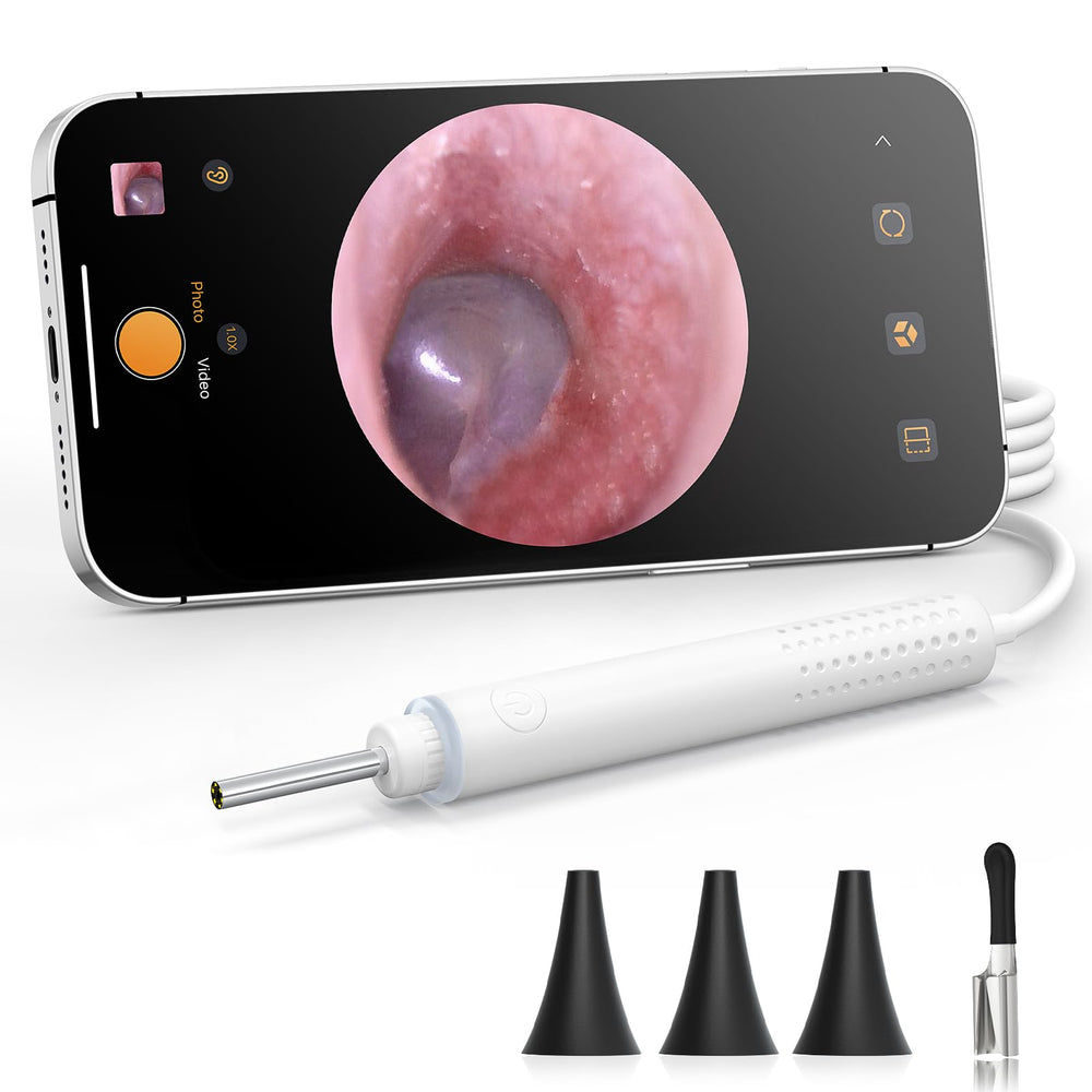 ScopeAround Otoscope avec lampe LED — vue claire du conduit auditif