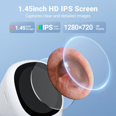 ScopeAround otoscope lentille 3,9 mm pour détails précis dans le conduit auditif.