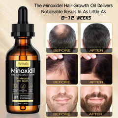 Sefralls Minoxidil barbe densifiant et favorisant la repousse
