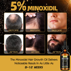 Sefralls Minoxidil 5% – texture onctueuse – application douce sur cuir chevelu