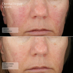 Sente Dermal Repair Crème Application visage et cou avec absorption rapide.