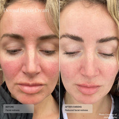 Sente Dermal Repair Crème Texture onctueuse apporte douceur.