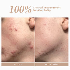 Flacon pompe du Rescue Serum avec aloe, hydratation douce.