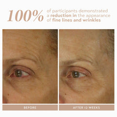 SHANI DARDEN Retinol Reform — application visage et cou avec texture satinée