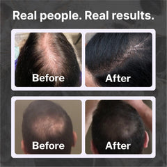 Shapiro MD Shampooing ingrédients naturels, formule végan pour cheveux sains.