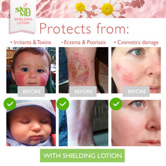 Sans parfum et sans colorant, Skin MD Shielding Lotion convient aux peaux sensibles