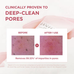 SKIN1004 Poremizing: nettoyage quotidien des pores pour peau fraîche et équilibrée.