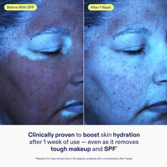 Skinfix cleanser dissolves SPF residue from skin after sun exposure