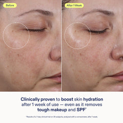 Skinfix Ceramide + Ectoine – peau propre sans dessèchement après lavage.
