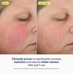 Mousse abondante Skinfix sur visage, douceur instantanée après rinçage.