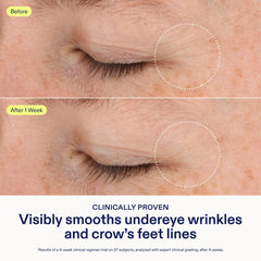 Application douce de Skinfix autour des yeux le matin et le soir.