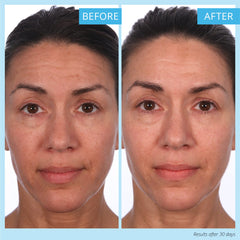Complexe ferulique‑rétinol‑vitamine C de SKINN Reverse revitalisant pour la peau.