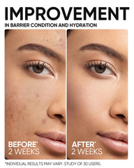 Probiotiques BFL du SKINTIFIC 5X, réduction possible des rougeurs.