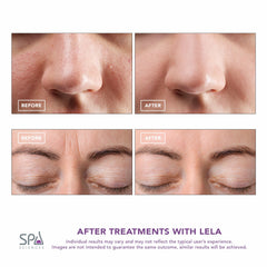 Spa Sciences LELA infusion de sérum—pénétration améliorée des soins.