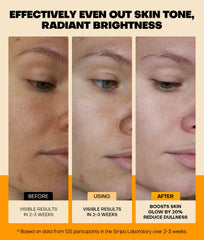 Srripo Sérum vitamine C 20% texture liquide légère et non collante.