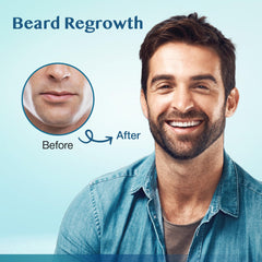 Zone barbe en régénération ciblée avec Stafenit Minoxidil.