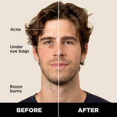 Mécanisme twist du bâton correcteur Stryx, dosage précis pour une couvrance légère.