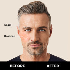 Stryx Concealer Tool démontrant une application sans résidu et naturelle.