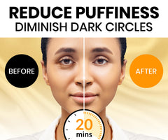 Patchs yeux Stylia vitamine C pour éclairer le regard et hydrater.